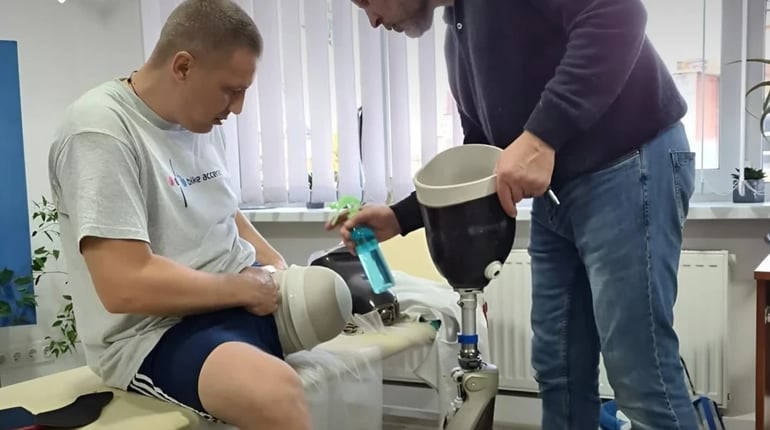 Для складних ампутацій змінюють правила протезування. Що це означає для пацієнтів