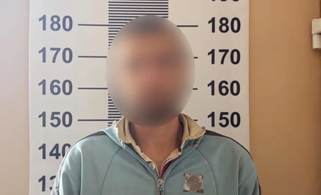 На Шепетівщині через ревнощі чоловік поранив знайомого сокирою